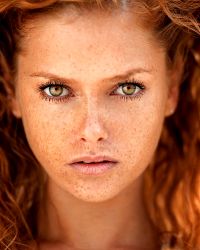 Pretty Girls With Freckles (24 Photos)